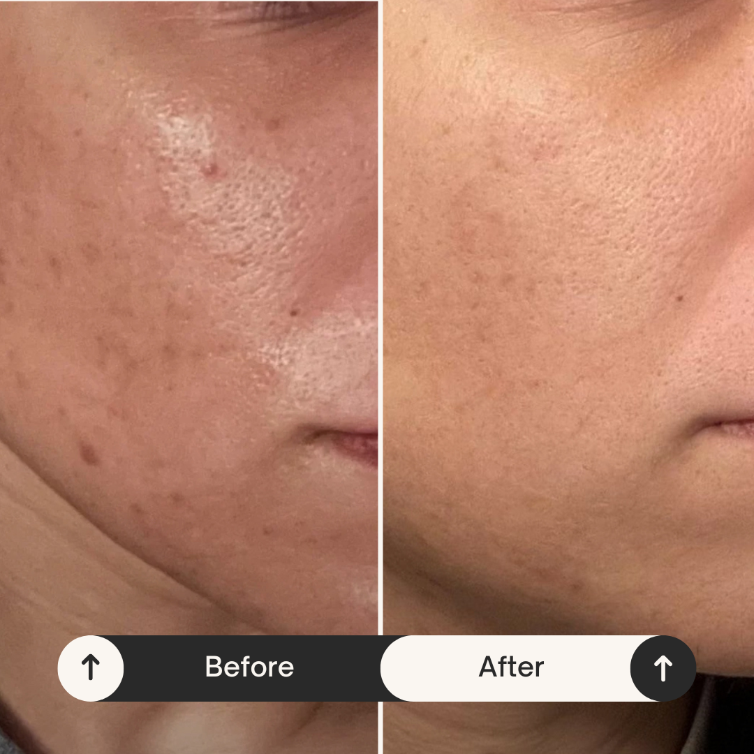 Avara Brightening Serum