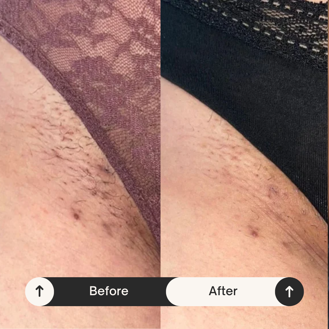Avara Brightening Serum